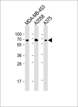 CD63 Antibody (C-term)
