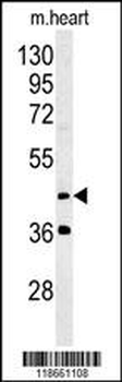 MYLIP Antibody (Center)