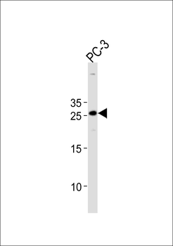 HOXC6 Antibody (C-term)