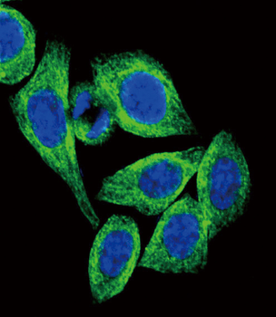 ADIPOR2 Antibody (Center)