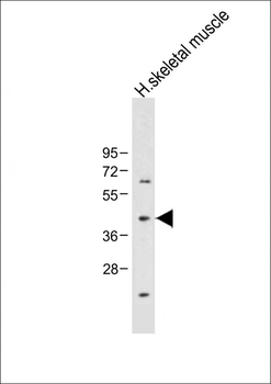ADIPOR2 Antibody (Center)