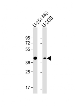 ADIPOR2 Antibody (Center)