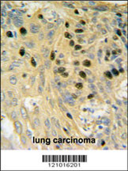 SMARCC1 Antibody (N-term)