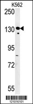 SMARCC1 Antibody (N-term)