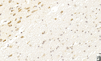 LINGO-1(LRRN6A)-S596 (C-term) Antibody