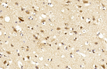 LINGO-1(LRRN6A)-S596 (C-term) Antibody