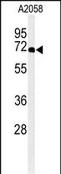 XRCC6 Antibody (C-term)