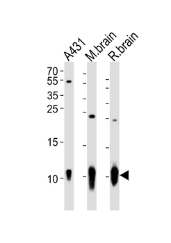 S100B Antibody
