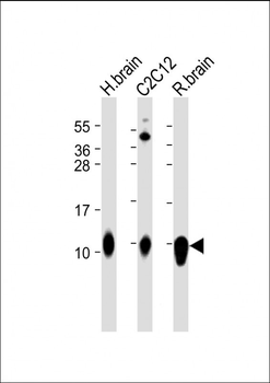 S100B Antibody