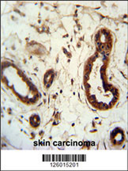 KRT82 Antibody (Center)
