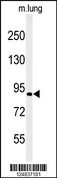 H6PD Antibody (C-term)
