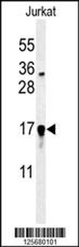 GLRX5 Antibody (C-term)