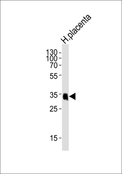 FOLR2 Antibody (N-term)