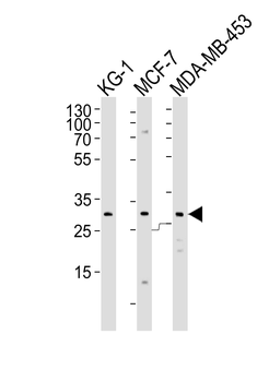 FOLR2 Antibody (N-term)