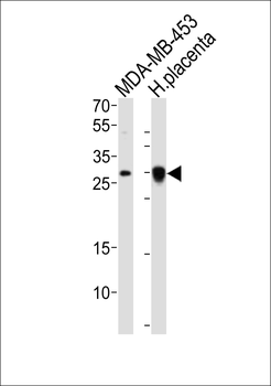 FOLR2 Antibody (N-term)
