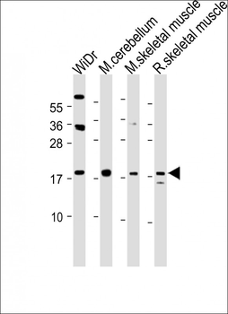 TPPP3 Antibody (C-term)
