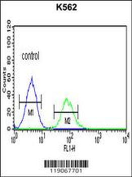 CHEK2 Antibody (N-term)