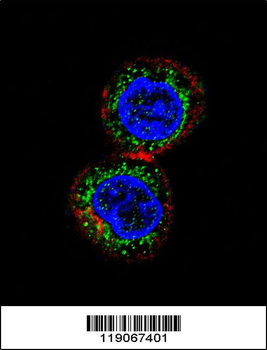CHEK2 Antibody (N-term)