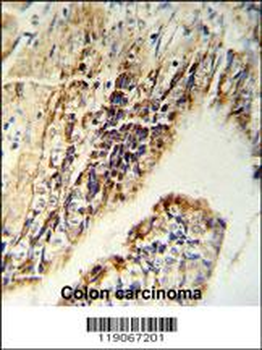 CHEK2 Antibody (N-term)