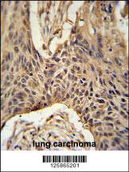LPPR4 Antibody (C-term)