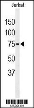 PAN3 Antibody (C-term)