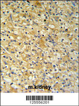 NAT8 Antibody (Center)