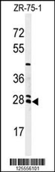 NAT8 Antibody (Center)