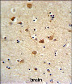 FCGR1A Antibody (Center)