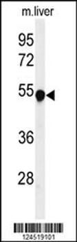 PAH Antibody (Center)