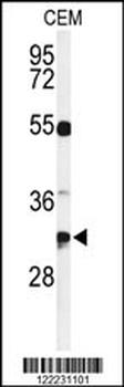 TSPAN7 Antibody (Center)