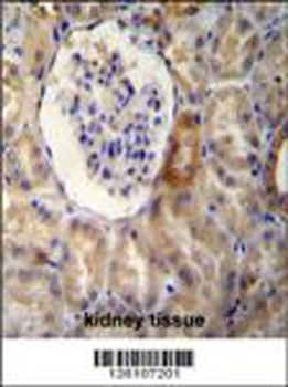 NR3C1 Antibody (C-term)