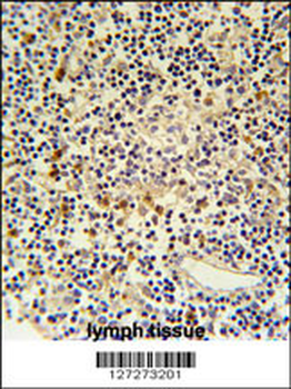 CORO6 Antibody (Center)