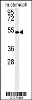 CORO6 Antibody (Center)