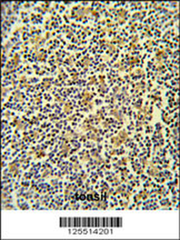 CORO6 Antibody (C-term)
