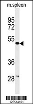 CORO6 Antibody (C-term)
