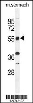 TOX3 Antibody (Center)