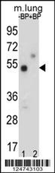 TOX3 Antibody (Center)