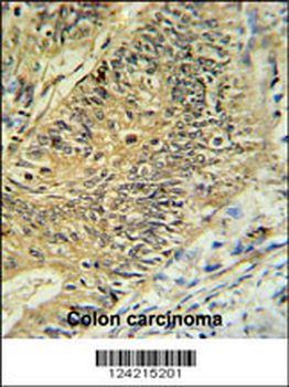 RPS15A Antibody (N-term)