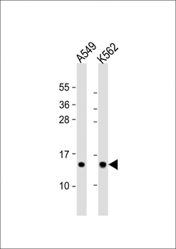 RPS15A Antibody (N-term)