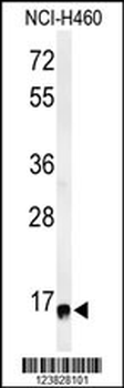 RPS13 Antibody (Center)