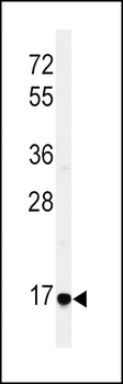 EREG Antibody (C-term)
