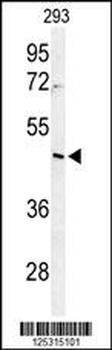 RRS1 Antibody (C-term)