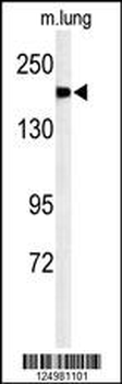 A2ML1 Antibody (N-term)