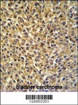 CRIP1 Antibody (C-term)