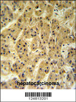 SC24A Antibody (Center)