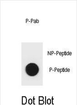 Phospho-mouse BAD(S96) Antibody