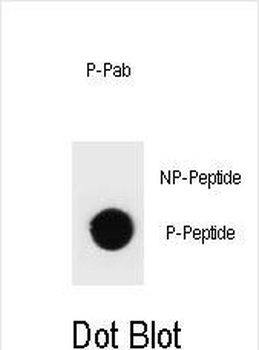 Phospho-rat TSC1(T417) Antibody