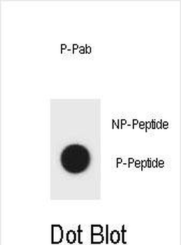 Phospho-mouse TSC1(Y304) Antibody