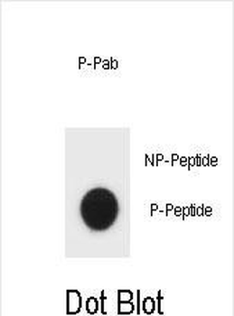 Phospho-mouse TSC1(S312) Antibody