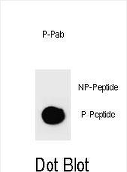Phospho-PARP1(S274) Antibody